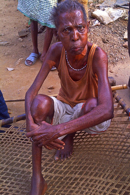 Starving in India: The Forgotten Problem Starving in India: The Forgotten Problem